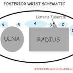 Schematic of the dorsal wrist tendons