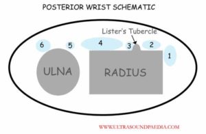 Schematic of the dorsal wrist tendons