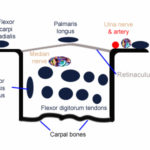 A basic schematic of the anterior wrist tendons and Carpal Tunnel. Click image to enlarge